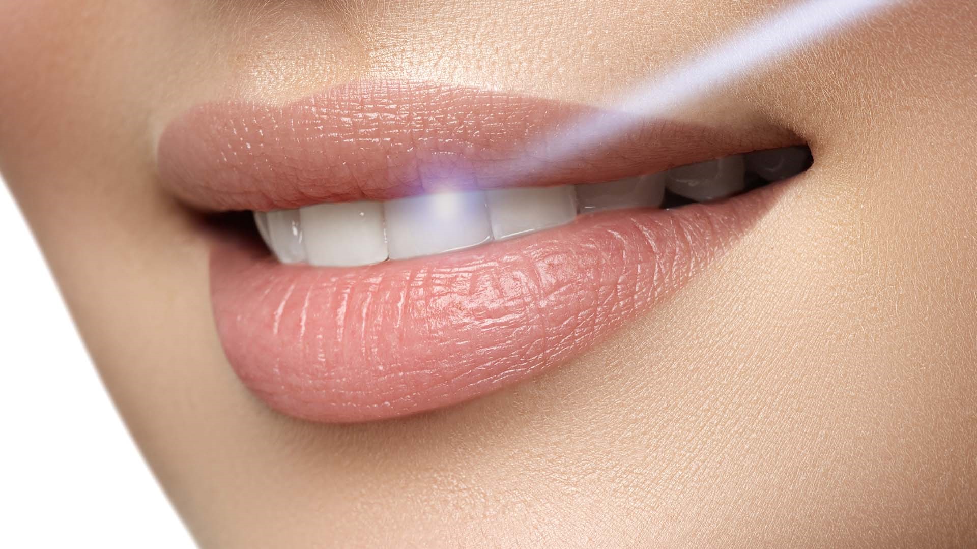 I vantaggi dell'utilizzo del laser