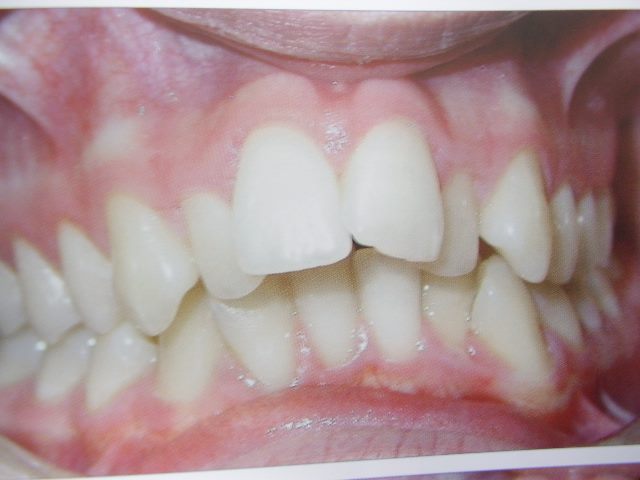 Prima del trattamento